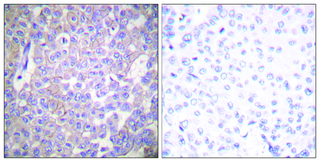 抗 Claudin 2 兔抗 affinity isolated antibody