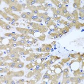 Anti-NDUFS3 antibody produced in rabbit