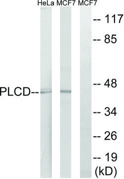 Anti-AGPAT4 antibody produced in rabbit affinity isolated antibody