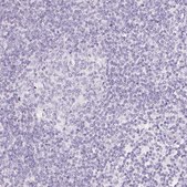Anti-SLC5A2 antibody produced in rabbit Prestige Antibodies® Powered by Atlas Antibodies, affinity isolated antibody, buffered aqueous glycerol solution