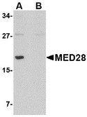 Anti-MED28 antibody produced in rabbit affinity isolated antibody