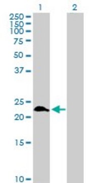 Anti-RAB9A antibody produced in rabbit purified immunoglobulin, buffered aqueous solution