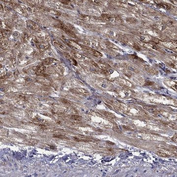 Anti-Ptgds Antibody Produced In Rabbit Prestige Antibodies&#174; Powered by Atlas Antibodies, affinity isolated antibody, buffered aqueous glycerol solution