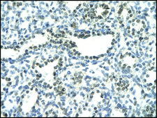 Anti-NFATC3 antibody produced in rabbit affinity isolated antibody