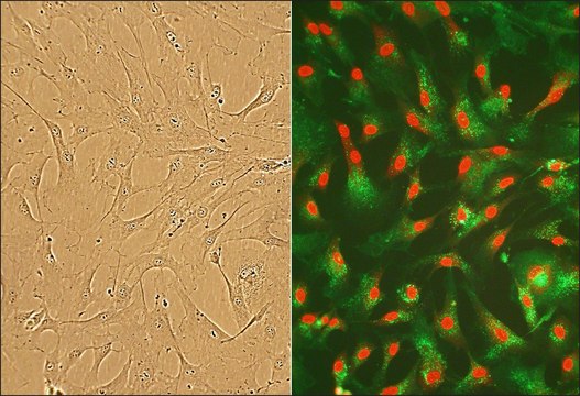 Human Cardiac Fibroblasts: HCF, adult