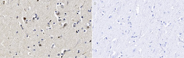 Anti-KDM2B/FBXL10 Antibody, clone 2F12 ZooMAb&#174; Rabbit Monoclonal recombinant, expressed in HEK 293 cells