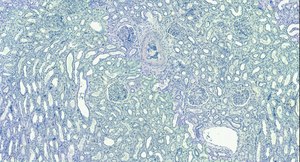 Anti-EWS/EWSR1 antibody produced in goat affinity isolated antibody, buffered aqueous solution