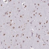 Anti-SEMA6B antibody produced in rabbit Prestige Antibodies® Powered by Atlas Antibodies, affinity isolated antibody, buffered aqueous glycerol solution