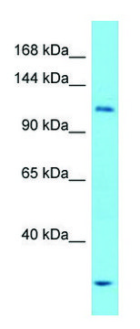 Anti-ULK1 (N-terminal) antibody produced in rabbit affinity isolated antibody