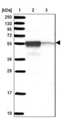 Anti-CHTF8 antibody produced in rabbit Prestige Antibodies® Powered by Atlas Antibodies, affinity isolated antibody, buffered aqueous glycerol solution