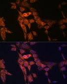 Anti-TWEAKR/Fn14/CD266 Antibody, clone 1G4T3, Rabbit Monoclonal