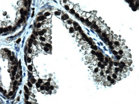 Anti-GREB1 Antibody, clone GREB1Ab clone GREB1Ab, from mouse