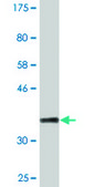 Monoclonal Anti-PYGM antibody produced in mouse clone 2C4, purified immunoglobulin, buffered aqueous solution