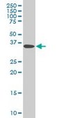 Monoclonal Anti-DCPS antibody produced in mouse clone 3E5, purified immunoglobulin, buffered aqueous solution