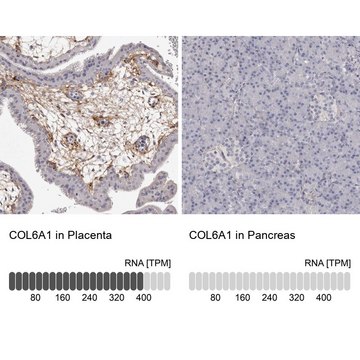 Anti-COL6A1 antibody produced in rabbit Prestige Antibodies&#174; Powered by Atlas Antibodies, affinity isolated antibody, buffered aqueous glycerol solution