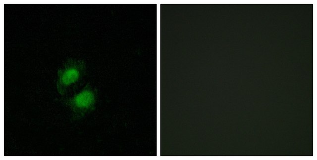 Anti-ZNF95 antibody produced in rabbit affinity isolated antibody