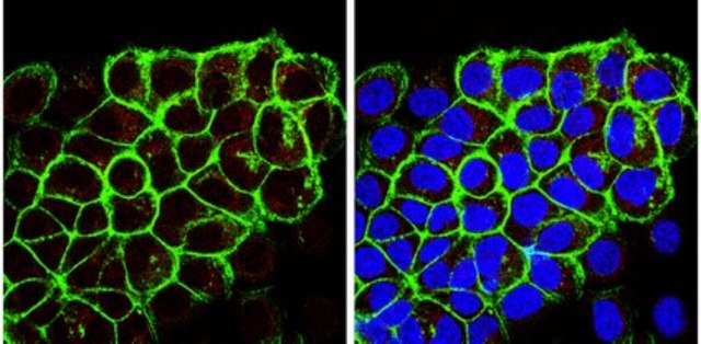 Anti-Ghrelin Antibody, clone 1ML-1D7 ascites fluid, clone 1ML-1D7, from mouse