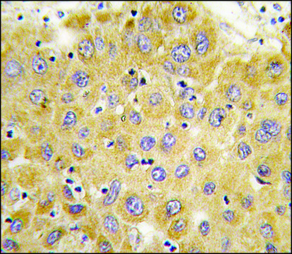 Anti-CTGF (C-term) antibody produced in rabbit saturated ammonium sulfate (SAS) precipitated, buffered aqueous solution