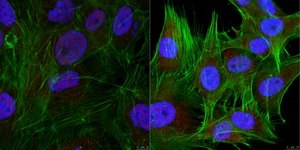 Anti-SMARCD2 (BAF60B) from rabbit, purified by affinity chromatography