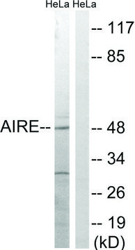 Anti-AIRE antibody produced in rabbit affinity isolated antibody