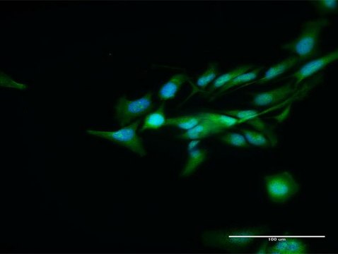 Anti-DCPS antibody produced in rabbit purified immunoglobulin, buffered aqueous solution