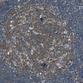 Anti-DDX3X antibody produced in rabbit Prestige Antibodies® Powered by Atlas Antibodies, affinity isolated antibody, buffered aqueous glycerol solution