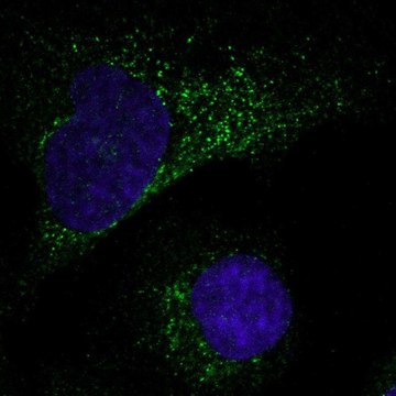 Anti-MMP1 antibody produced in rabbit Prestige Antibodies&#174; Powered by Atlas Antibodies, affinity isolated antibody