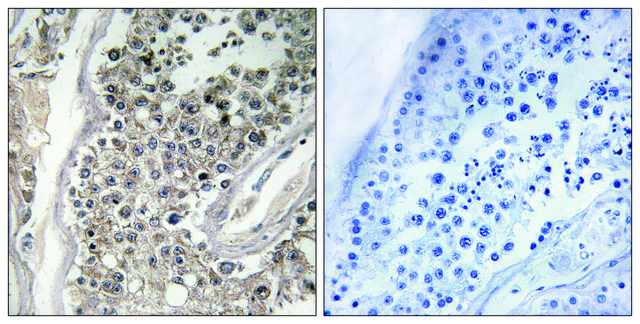 Anti-RAB3GAP1 antibody produced in rabbit affinity isolated antibody