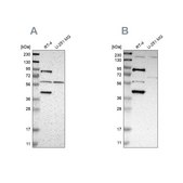 Anti-C1orf116 antibody produced in rabbit Prestige Antibodies® Powered by Atlas Antibodies, affinity isolated antibody, buffered aqueous glycerol solution
