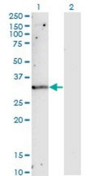 Monoclonal Anti-TIMP1 antibody produced in mouse clone 4D12, purified immunoglobulin, buffered aqueous solution