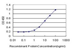 Monoclonal Anti-IRAK3 antibody produced in mouse clone 1A6, purified immunoglobulin, buffered aqueous solution