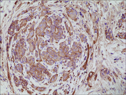 Anti-Alpha Actinin-4 antibody, Rabbit Monoclonal recombinant, expressed in HEK 293 cells, clone RM287, purified immunoglobulin