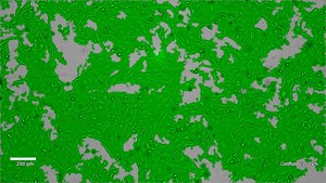 LX-2 Cas9 Human Hepatic Stellate Cell Line