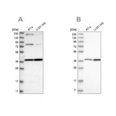 Anti-MECR antibody produced in rabbit Prestige Antibodies® Powered by Atlas Antibodies, affinity isolated antibody, buffered aqueous glycerol solution, Ab1