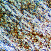Anti-phospho-IR (pTyr1355) antibody produced in rabbit affinity isolated antibody