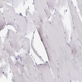 Anti-DERL2 antibody produced in rabbit Prestige Antibodies® Powered by Atlas Antibodies, affinity isolated antibody, buffered aqueous glycerol solution