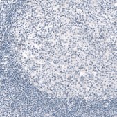 Monoclonal Anti-TYRP1 antibody produced in mouse Prestige Antibodies® Powered by Atlas Antibodies, clone CL4906, purified immunoglobulin, buffered aqueous glycerol solution