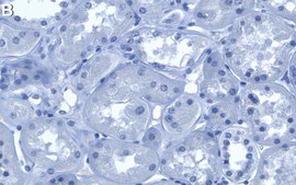 Anti-LAMTOR1 Antibody, clone 1M19 ZooMAb® Rabbit Monoclonal recombinant, expressed in HEK 293 cells