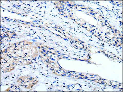 Anti-LINGO1 affinity isolated antibody