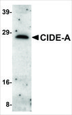Anti-CIDE-A (ab1) antibody produced in rabbit affinity isolated antibody, buffered aqueous solution