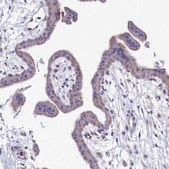 Anti-VPS26B antibody produced in rabbit Prestige Antibodies® Powered by Atlas Antibodies, affinity isolated antibody, buffered aqueous glycerol solution