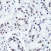 Anti-Symmetric DiMethyl-Histone H3-R2 antibody produced in rabbit