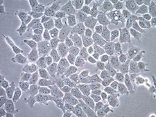 HOG Human Oligodendroglioma Cell Line HOG human oligodendroglioma cell line is a useful model to study the role of oligodendrocytes in neurodegenerative diseases.