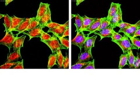 Anti-PHLPP1 Antibody from rabbit, purified by affinity chromatography