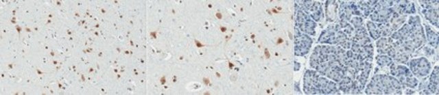 Anti-PQBP1 Antibody, clone 7A1.1 clone 7A1.1, from mouse