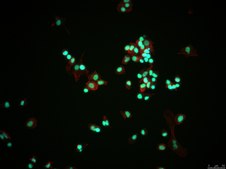 VOA1066 Human Undifferentiated Endometrial Carcinoma Cell Line