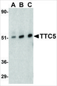 Anti-TTC5 antibody produced in rabbit affinity isolated antibody, buffered aqueous solution