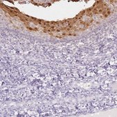 Anti-SPRR3 antibody produced in rabbit Prestige Antibodies® Powered by Atlas Antibodies, affinity isolated antibody, buffered aqueous glycerol solution