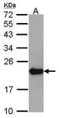 Anti-RPL24 antibody produced in rabbit affinity isolated antibody, buffered aqueous solution