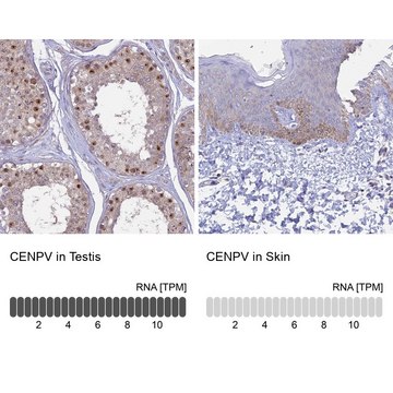 Anti-CENPV antibody produced in rabbit Prestige Antibodies&#174; Powered by Atlas Antibodies, affinity isolated antibody, buffered aqueous glycerol solution